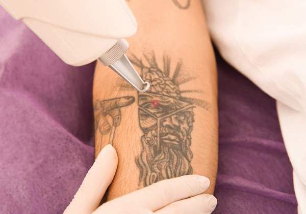 How Safe Is Your Favorite Tattoo?