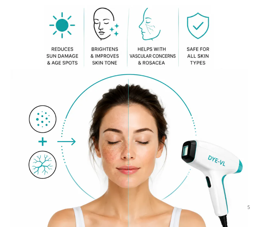 DYE_VL skin-treatment Douglasdale Calgary SE